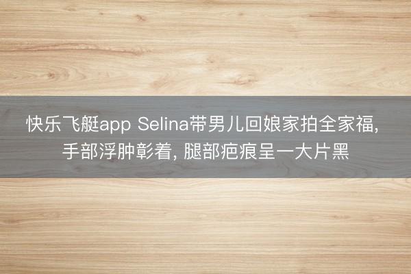 快乐飞艇app Selina带男儿回娘家拍全家福， 手部浮肿彰着， 腿部疤痕呈一大片黑